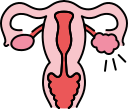 Ectopic Pregnancies